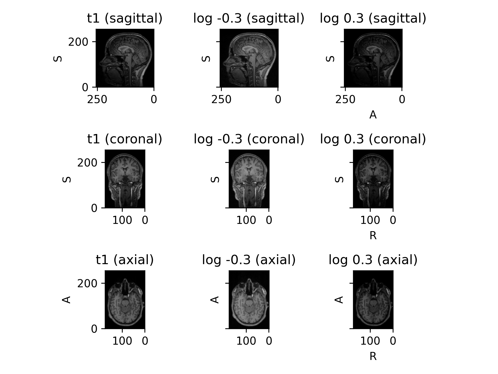 ../_images/augmentation-4.png