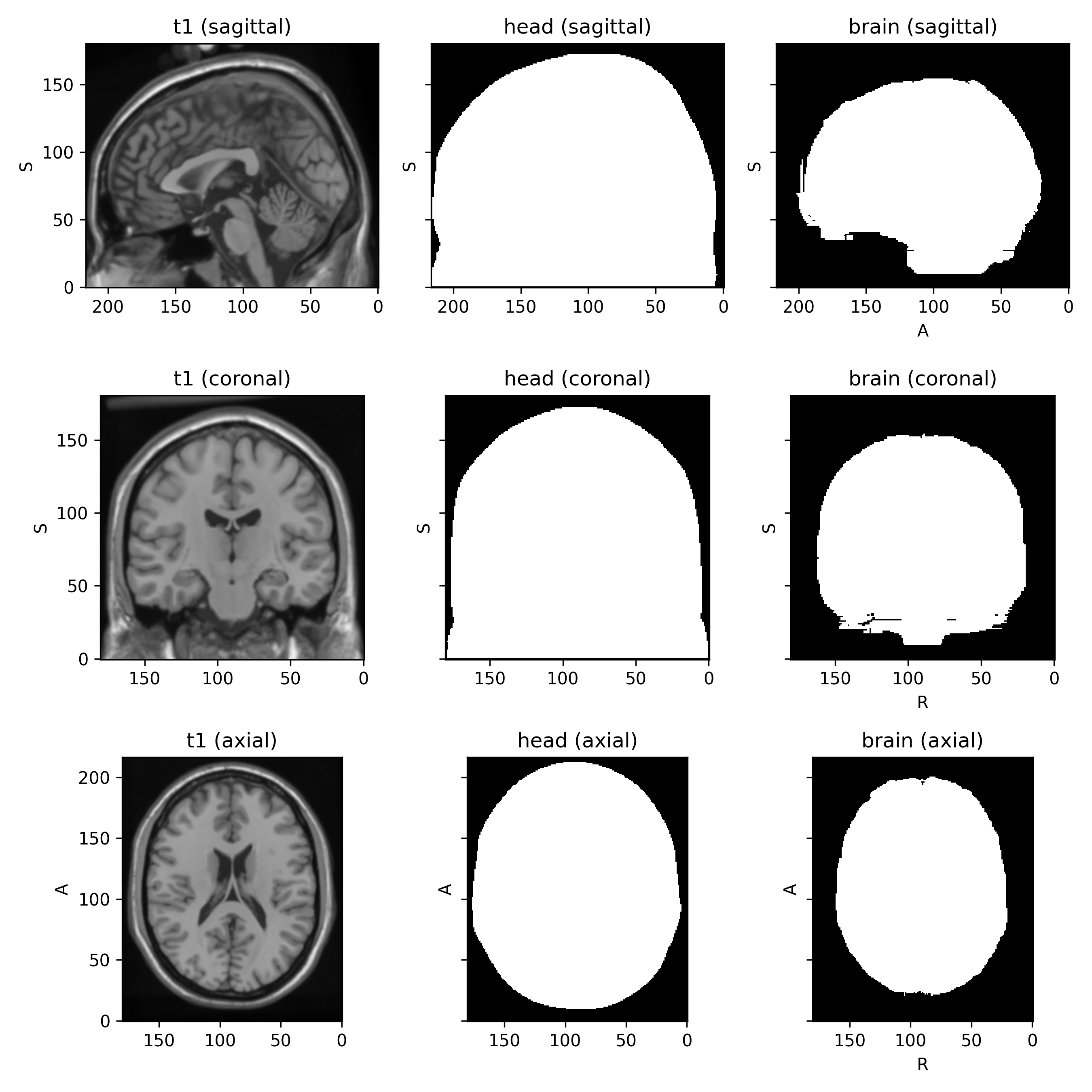 _images/datasets-1_00.png
