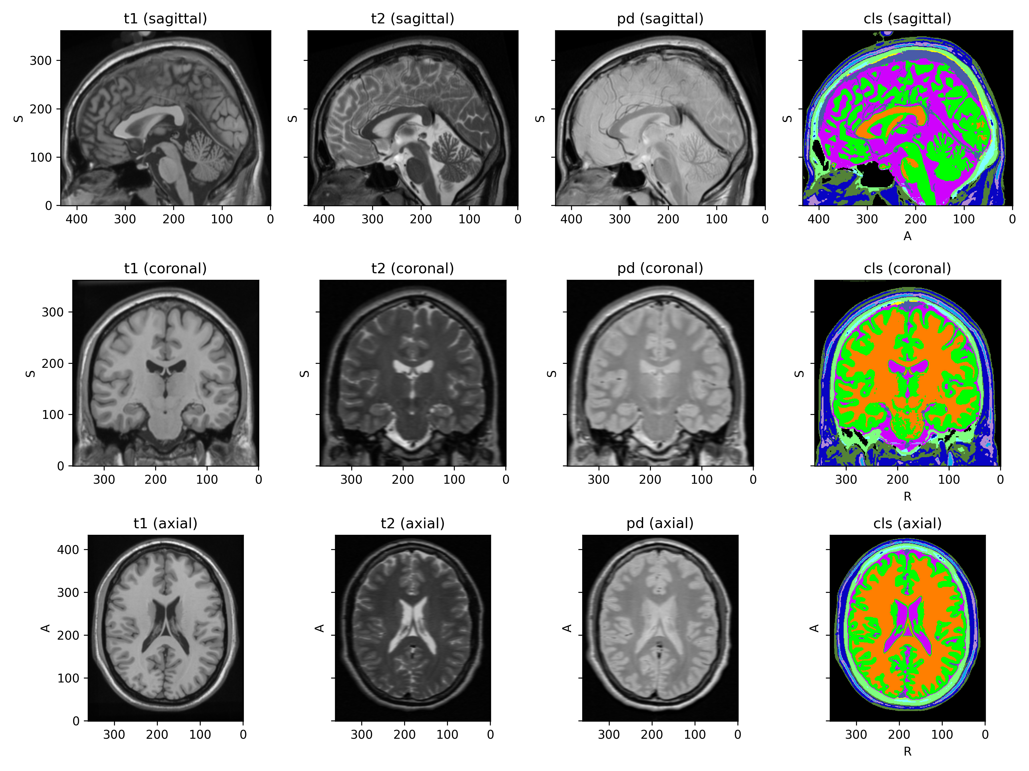_images/datasets-1_01.png