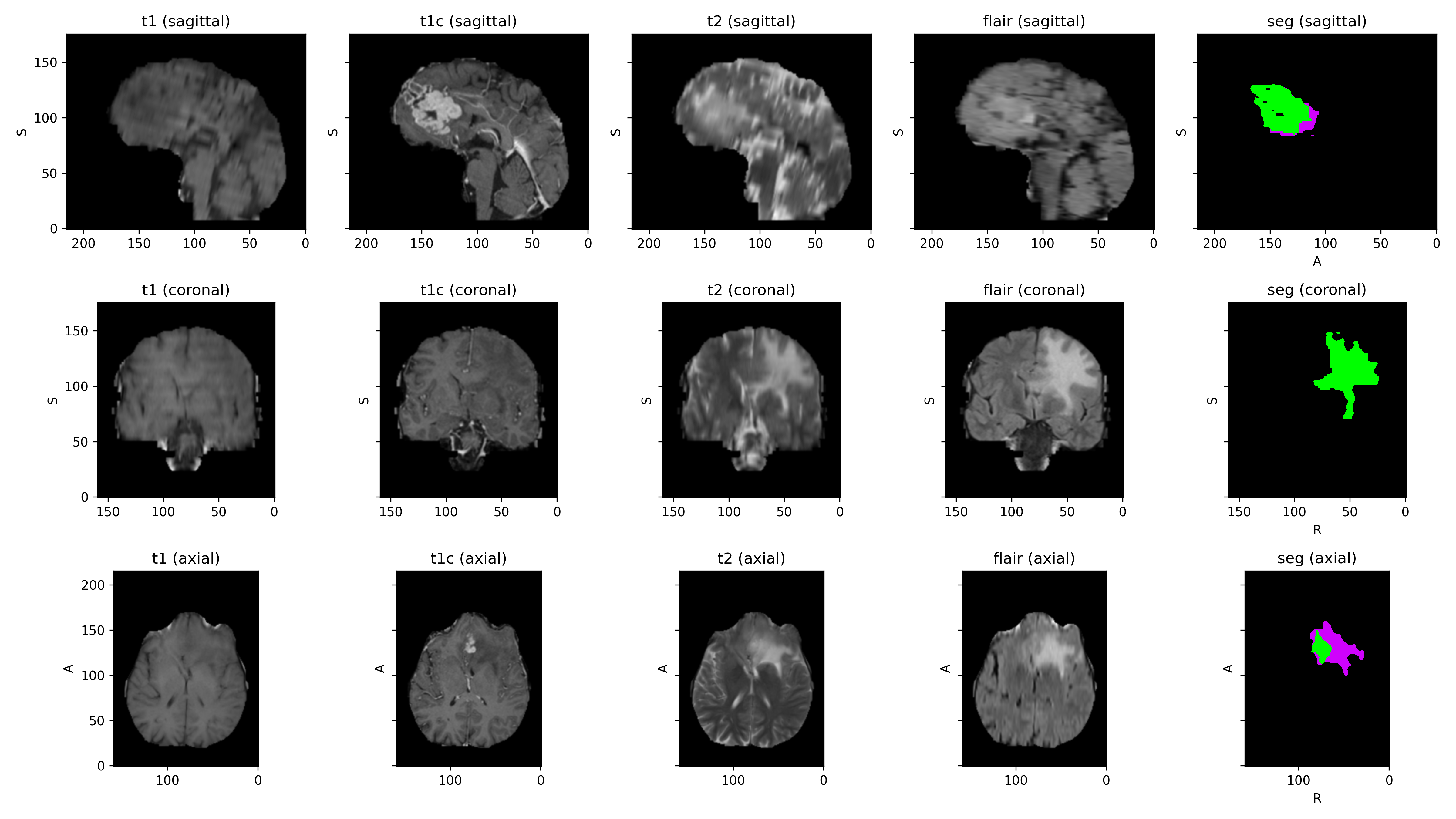 _images/datasets-4.png