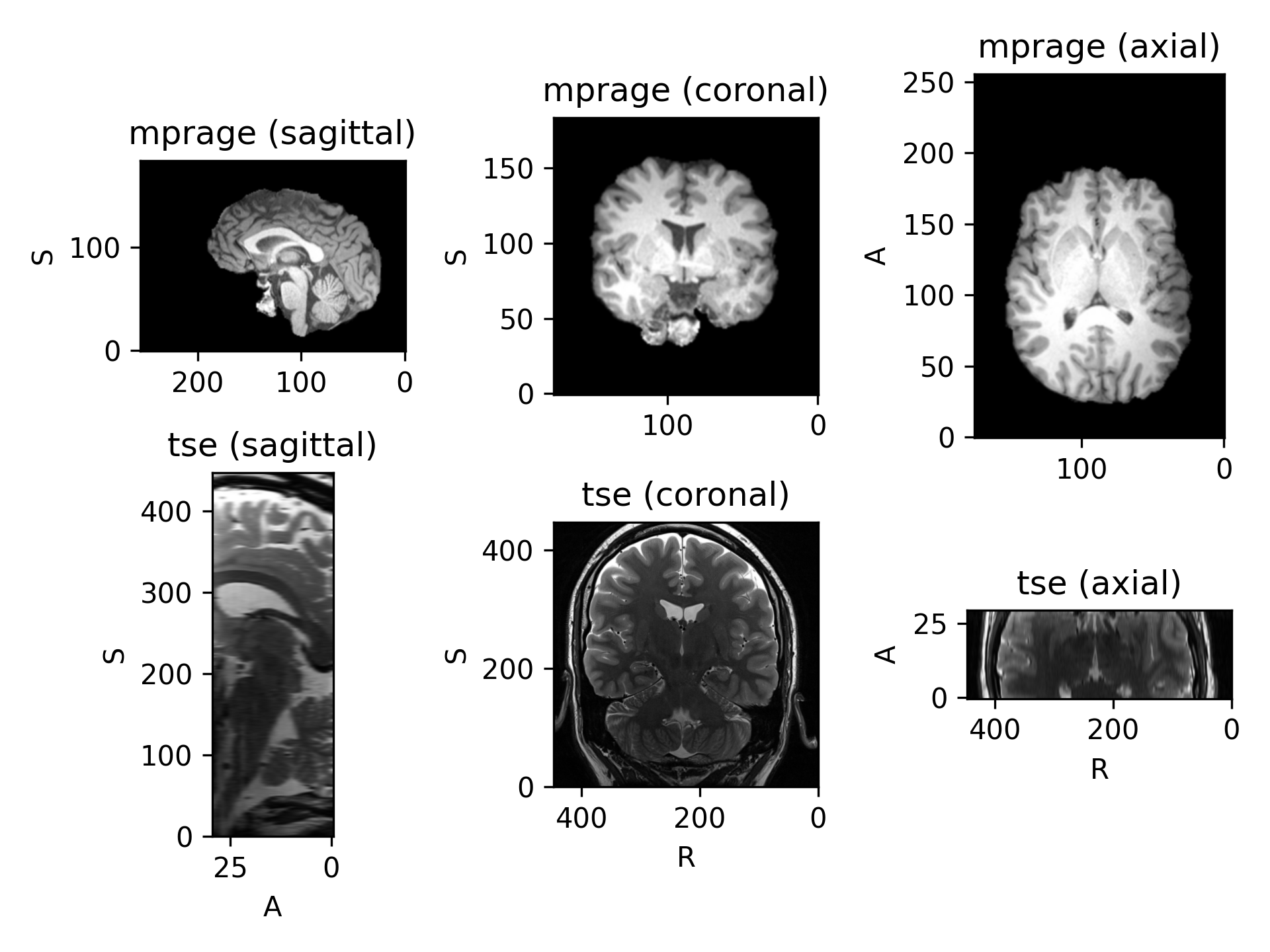 _images/datasets-5.png