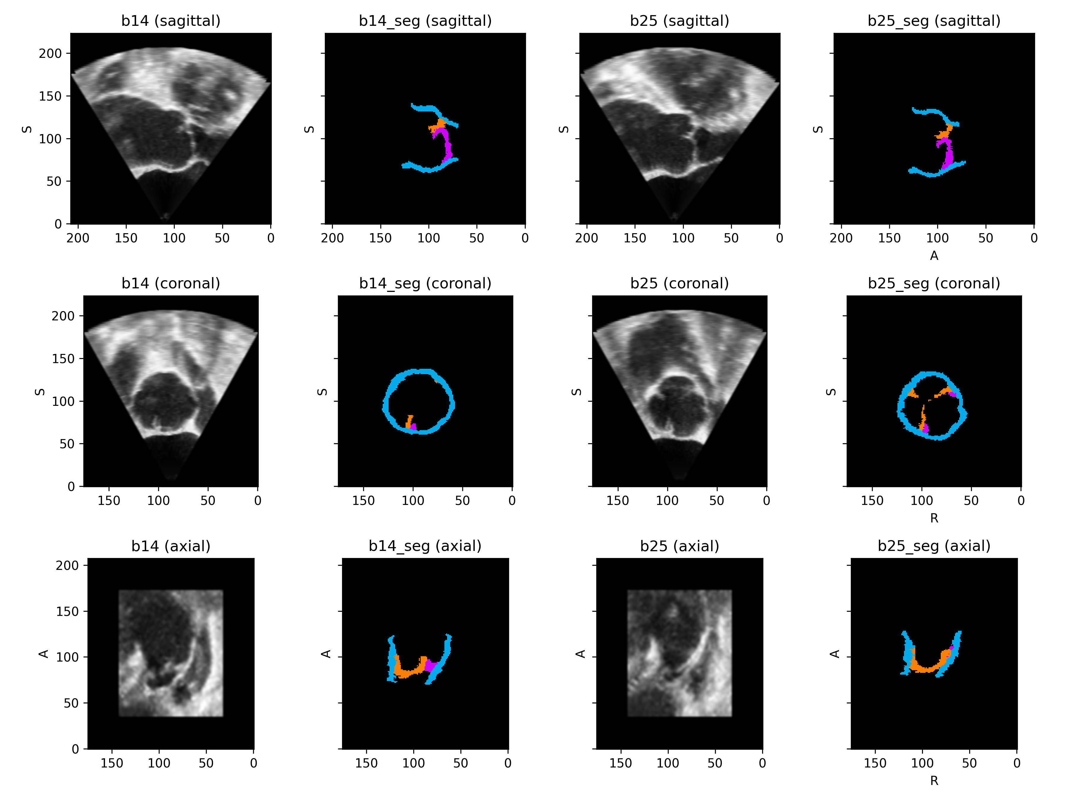 _images/datasets-6.png