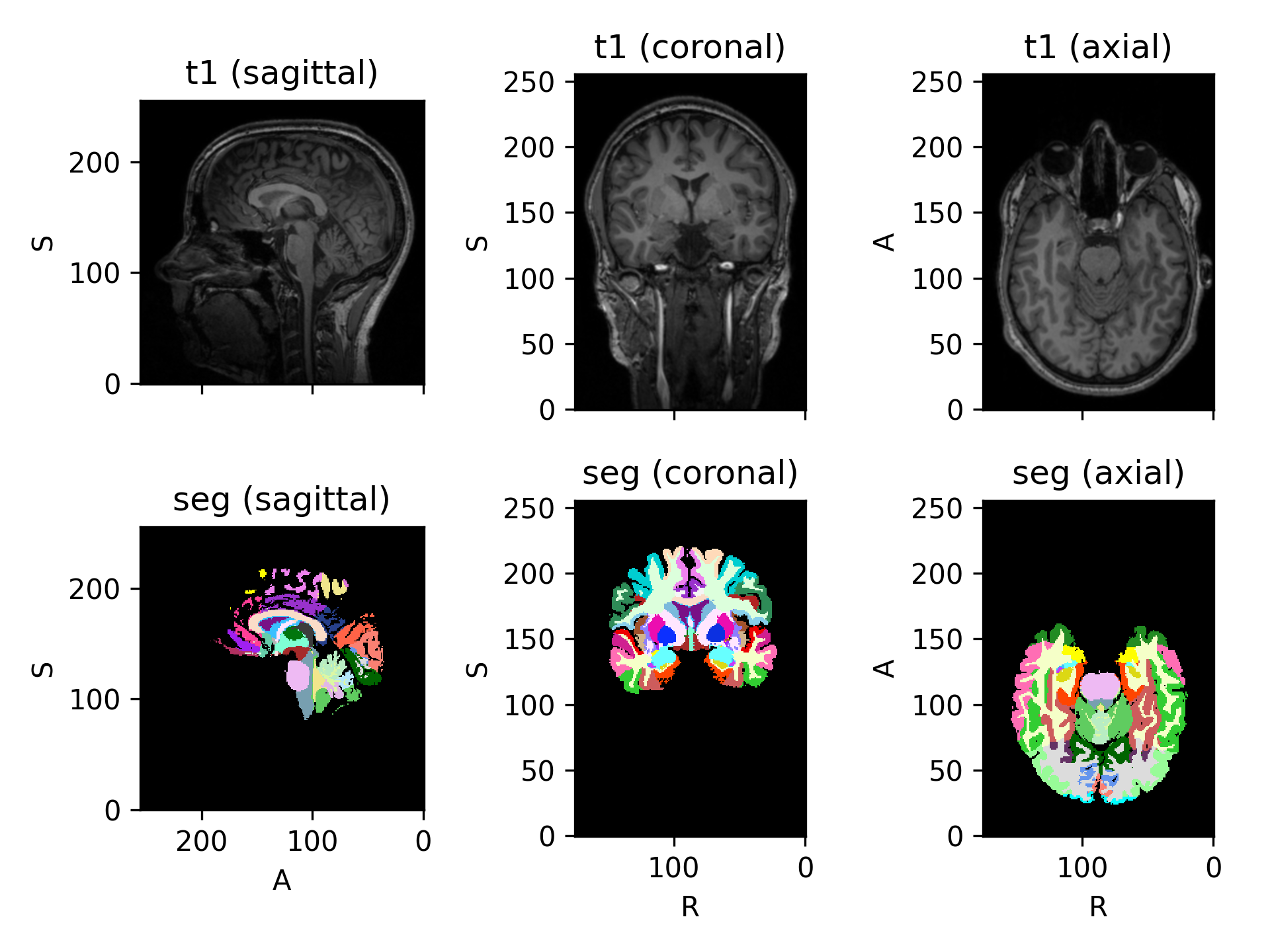 _images/datasets-8.png