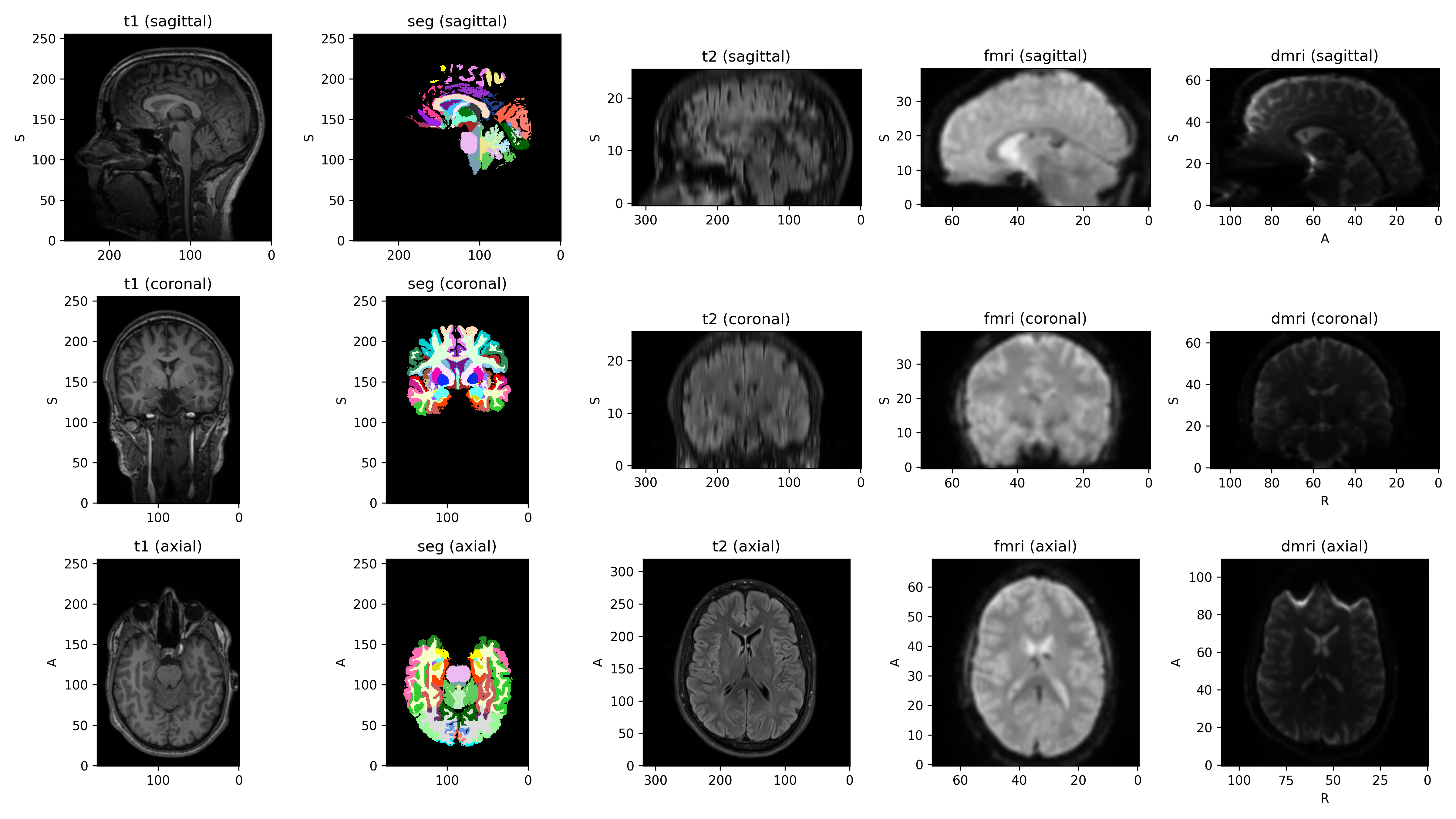 _images/datasets-9.png