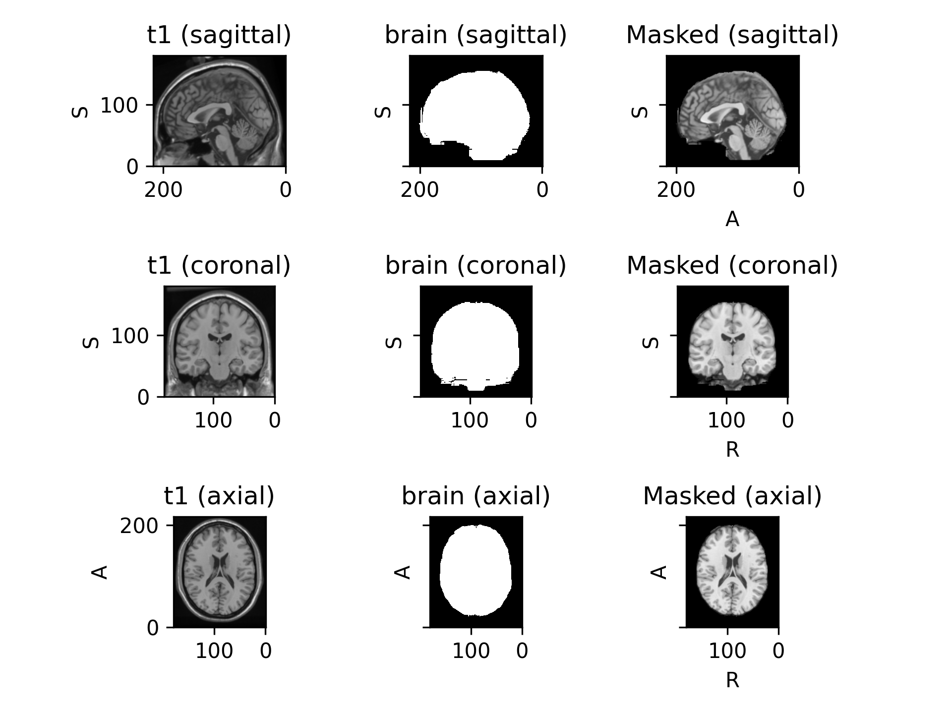 ../_images/preprocessing-1.png