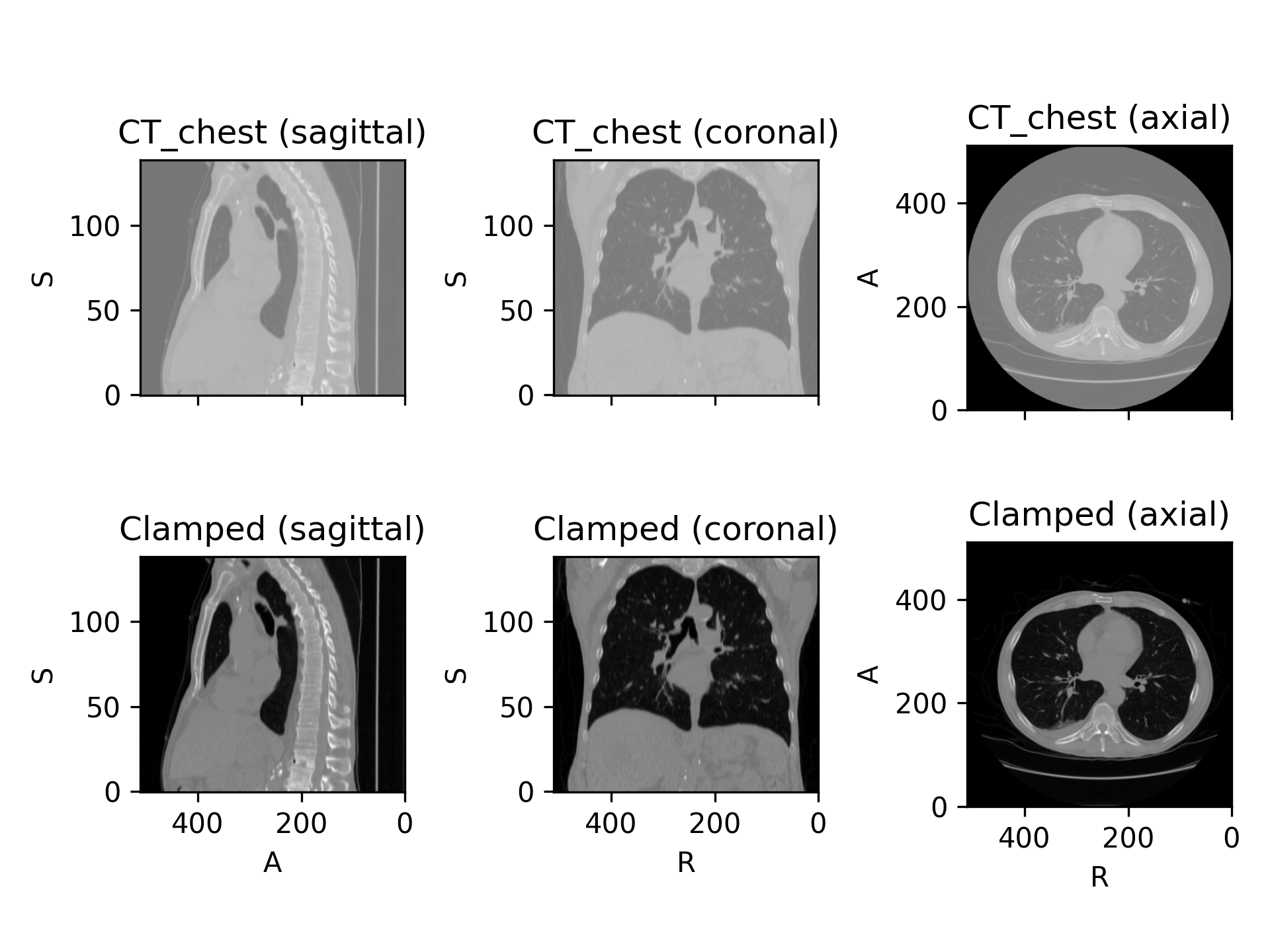 ../_images/preprocessing-2.png