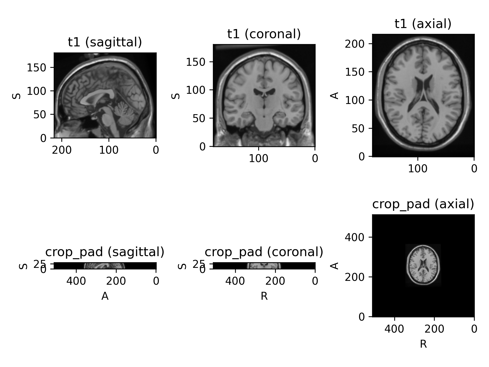../_images/preprocessing-3.png