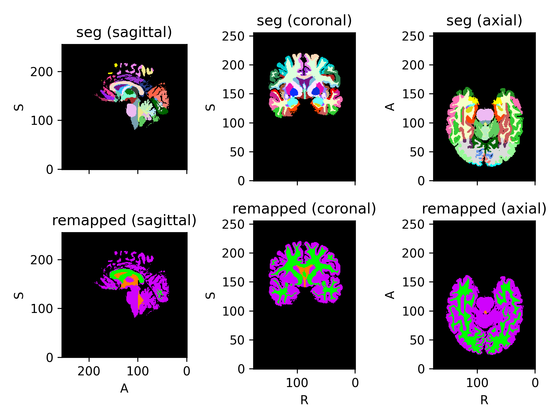 ../_images/preprocessing-5.png