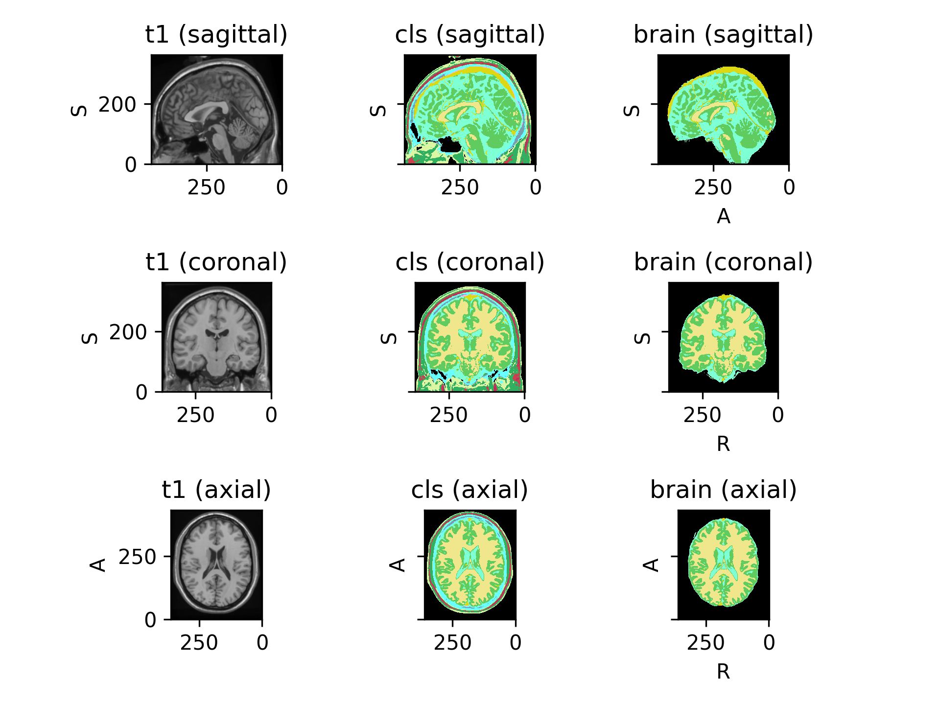 ../_images/preprocessing-6.png