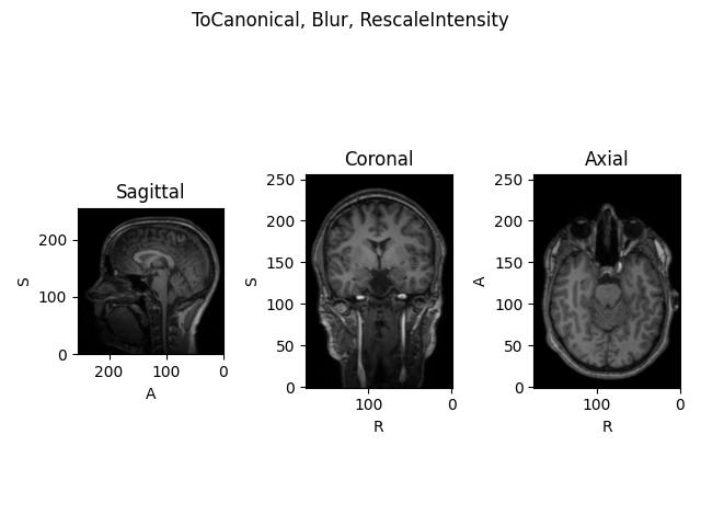 ToCanonical, Blur, RescaleIntensity, Sagittal, Coronal, Axial