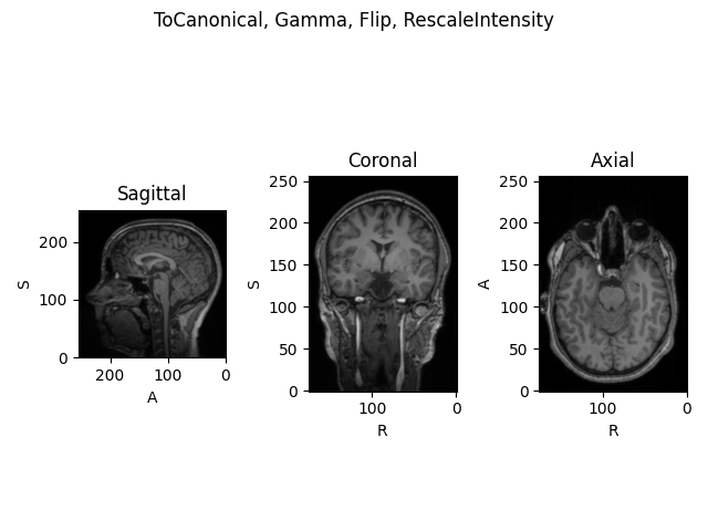 ToCanonical, Gamma, Flip, RescaleIntensity, Sagittal, Coronal, Axial