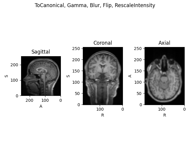 ToCanonical, Gamma, Blur, Flip, RescaleIntensity, Sagittal, Coronal, Axial