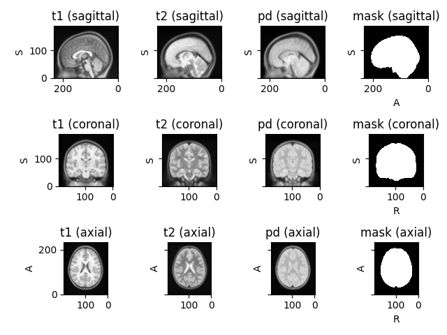 t1 (sagittal), t2 (sagittal), pd (sagittal), mask (sagittal), t1 (coronal), t2 (coronal), pd (coronal), mask (coronal), t1 (axial), t2 (axial), pd (axial), mask (axial)