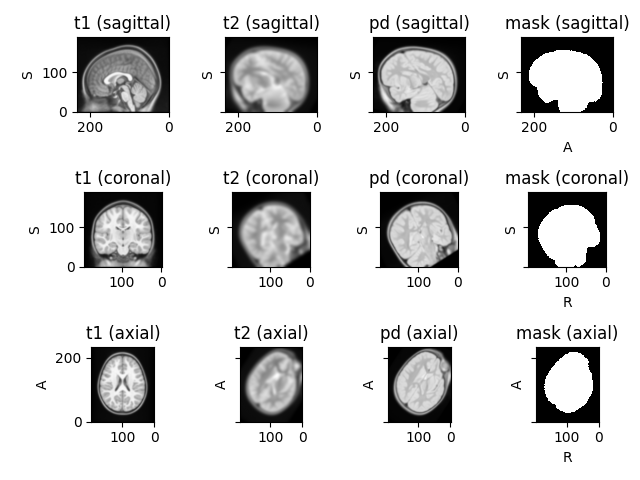t1 (sagittal), t2 (sagittal), pd (sagittal), mask (sagittal), t1 (coronal), t2 (coronal), pd (coronal), mask (coronal), t1 (axial), t2 (axial), pd (axial), mask (axial)